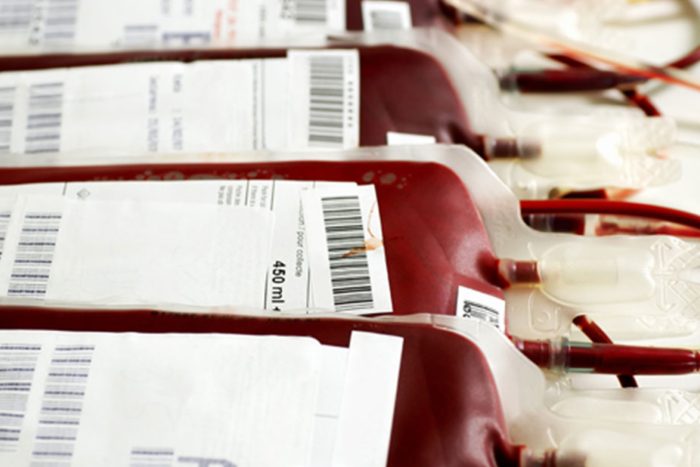 Busoga in urgent need of a blood bank